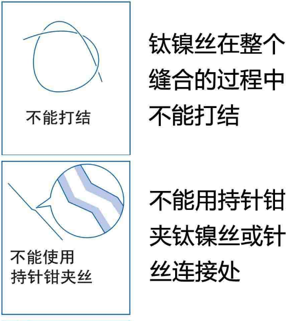 【兆恒機械】鈦鎳記憶合金組織吻合器使用注意事項